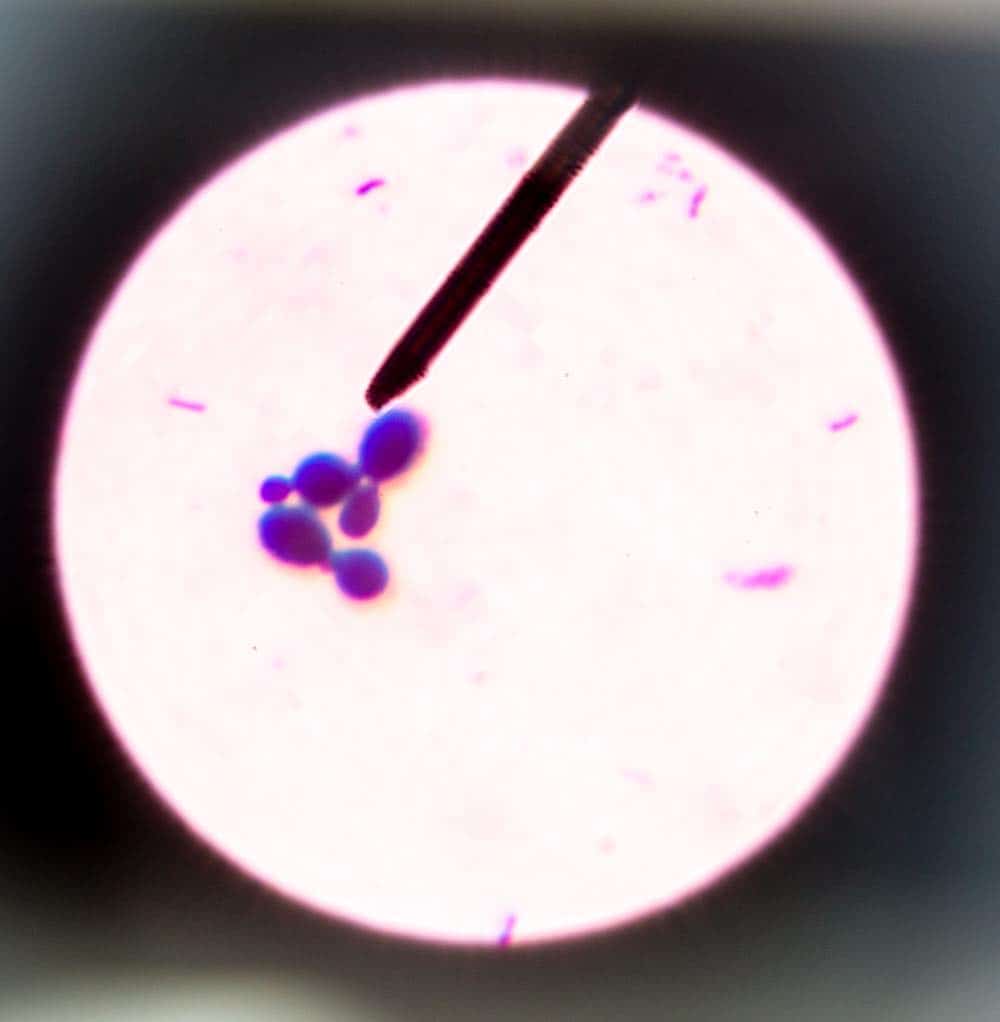 spirende gærceller vist under et mikroskop